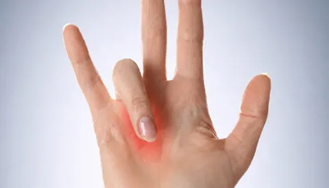 Schnellender Finger: Wenn die Finger plötzlich blockieren